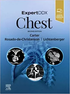 Expertddx: Chest