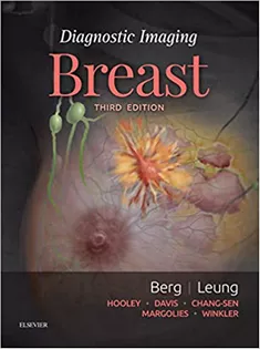 9780323548120 Diagnostic Imaging: Breast