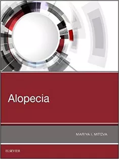 9780323548250 Alopecia