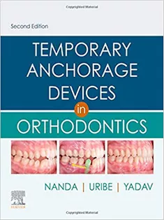 Temporary Anchorage Devices in Orthodontics