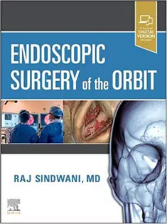 Endoscopic Surgery of the Orbit