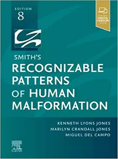 Smith's Recognizable Patterns of Human Malformation