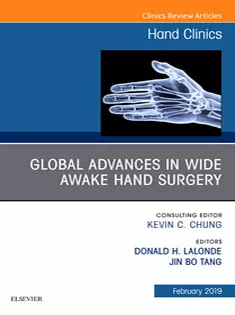 Global Advances in Wide Awake Hand Surgery An Issue of Hand Clinics