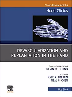 Revascularization and Replantation in the Hand, An Issue of Hand Clinics