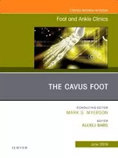 9780323682084 The Cavus Foot, An Issue of Foot and Ankle Clinics of North America