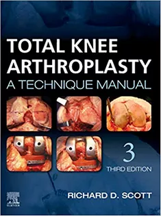 Total Knee Arthroplasty