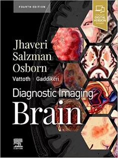 9780323756204 Diagnostic Imaging: Brain