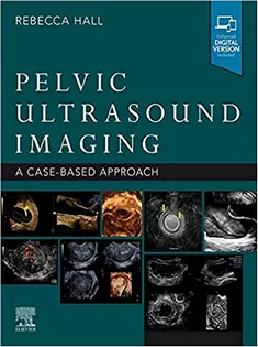 Pelvic Ultrasound Imaging : A Cased-Based Application