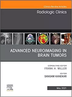Advanced Neuroimaging in Brain Tumors, An Issue of Radiologic Clinics of North America-Volume 59-3