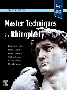 Master Techniques in Rhinoplasty