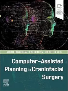 Computer-Assisted Planning in Craniofacial Surgery