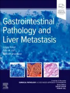 Gastrointestinal Pathology and Liver Metastasis