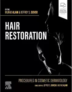 Procedures in Cosmetic Dermatology: Hair Restoration