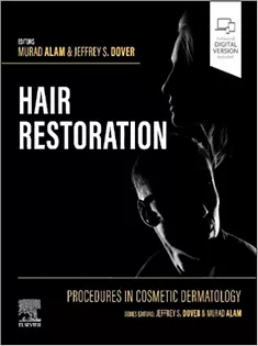 Procedures in Cosmetic Dermatology: Hair Restoration