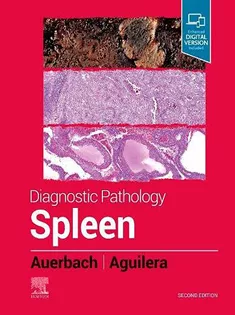 9780323830126 Diagnostic Pathology: Spleen