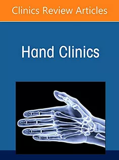9780323835787 Use of Sonography in Hand/Upper Extremity Surgery - Innovative Concepts and Techniques, An Issue of Hand Clinics