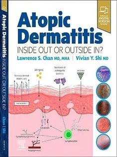 Atopic Dermatitis: Inside Out or Outside In