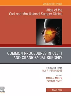 Cleft and Craniofacial Surgery, An Issue of Atlas of the Oral & Maxillofacial Surgery Clinics