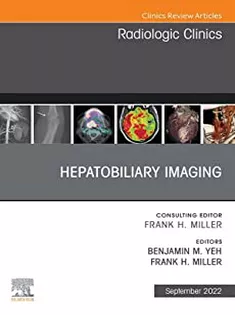 9780323849241 Hepatobiliary Imaging, An Issue of Radiologic Clinics of North America