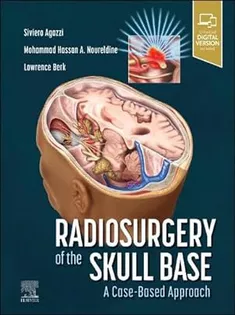 Radiosurgery of the Skull Base: A Case-Based Approach