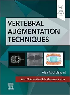 9780323882262 Vertebral Augmentation Techniques