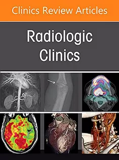 9780323897648 Thoracic Infections, An Issue of Radiologic Clinics of North America