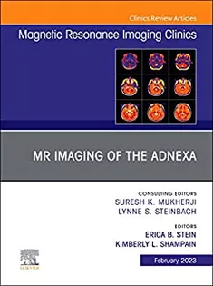Vascular Anesthesia, An Issue of Anesthesiology Clinics
