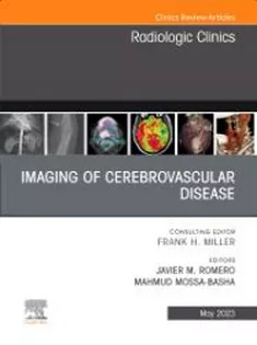 9780323940092 Imaging of Cerebrovascular Disease, An Issue of Radiologic Clinics of North America