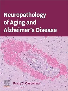 Neuropathology of Aging and Alzheimer’s Disease