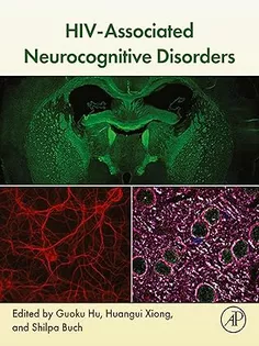 HIV-Associated Neurocognitive Disorders