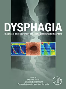 Dysphagia: Diagnosis and Treatment of Esophageal Motility Disorders