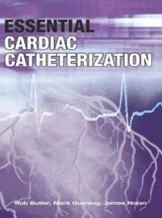 Essential Cardiac Catheterization