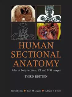 Human Sectional Anatomy Atlas of Body Sections CT & MRI Images