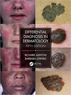 9780367085971 Differential Diagnosis in Dermatology