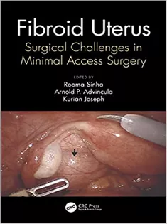 Fibroid Uterus: Surgical Challenges in Minimal Access Surgery