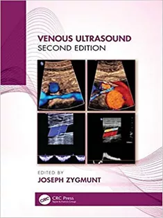 Venous Ultrasound