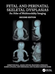 Fetal and Perinatal Skeletal Dysplasias: An Atlas of Multimodality Imaging