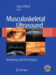Musculoskeletal Ultrasound