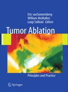 Tumor Ablation: Principles and Practice