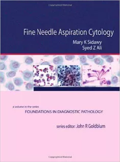 Fine Needle Aspiration Cytology