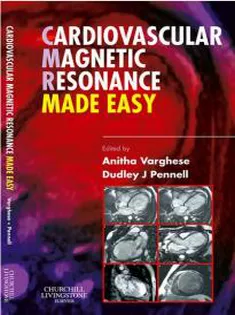Cardiovascular Magnetic Resonance Made Easy