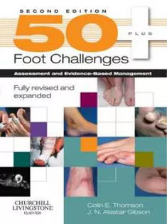 Foot Challenges 50: Assessment and Evidence-Based Management