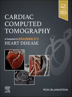 Cardiac Computed Tomography
