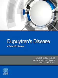 9780443114878 Dupuytren's Disease : A Scientific Review