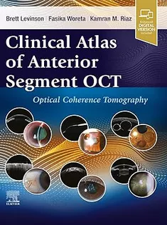 Clinical Atlas of Anterior Segment OCT