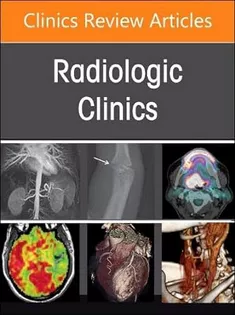 9780443130175 Spine Imaging and Intervention, An Issue of Radiologic Clinics of North America