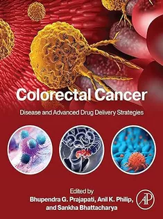 Colorectal Cancer: Disease and Advanced Drug Delivery Strategies