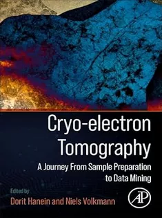 Cryo-Electron Tomography: A Journey from Sample Preparation to Data Mining