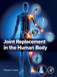 Joint Replacement in the Human Body