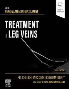 Procedures in Cosmetic Dermatology Series: Treatment of Leg Veins